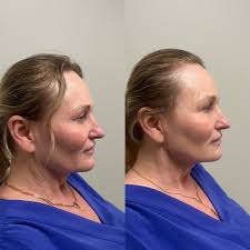 Alli Hansen, RN, PHN (@aestheticsby_alli) • Instagram photos and videos