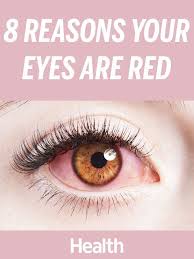 8 Reasons Your Eyes Are Red And How To Treat Them Red Eye Causes Bloodshot Eye Causes What Causes Red Eyes