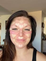 Valentine's proposal spot before and after