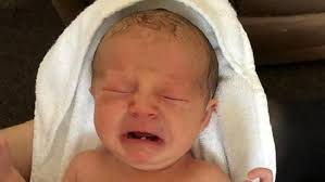 Treffen eine oder mehrere symptome auf dein baby zu? Plymouth Baby Bekommt Zahn Gezogen Mit 12 Tagen