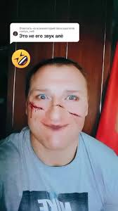 Кошка Лана Спалила Лицо Без Маски