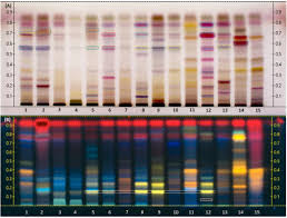 Image result for Combretum oxystachyum