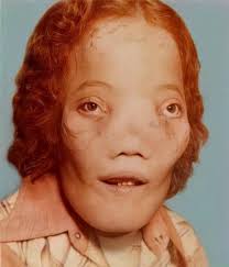 Old Car Pedal Configuration