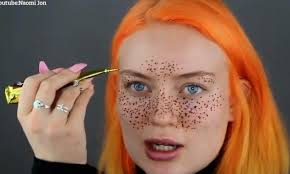 Woman Left With Red Splodges On Her Face From Trying To Give Herself Semi Permanent Freckles With Henna