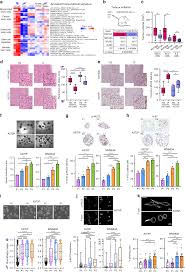 Check spelling or type a new query. Wnt11 Fzd7 Daam1 Signalling Supports Tumour Initiating Abilities And Melanoma Amoeboid Invasion Nature Communications