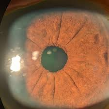 Image result for Pseudoconyza