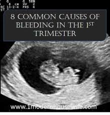 Home pregnancy pregnancy week by week 7 weeks pregnant: 8 Common Causes For Bleeding In The First Trimester Wehavekids
