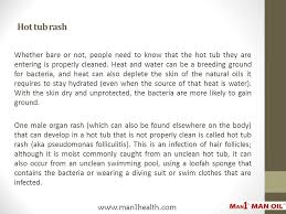 We did not find results for: Male Organ Rash From The Hot Tub Ppt Download
