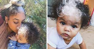 Sometimes, these patches can be itchy and their edges can be inflamed, red, or brownish. Pin On Videos Interesting Articles Music