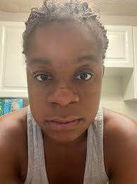 Anyone know what this weird dark spot is