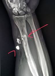 Herzlich willkommen bei egun dem marktplatz für jäger, schützen und angler. Pin On X Rays