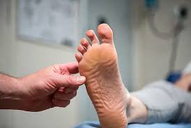 Image result for Babinski Reflex