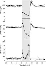 Image result for FHR Variability