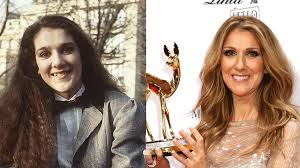 The 16 best met gala hair accessories of all time, from subtle to subversive. Celine Dion Son Avant Apres Chirurgie Photos
