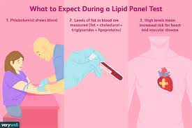 Lipid Panel Uses Side Effects Procedure Results