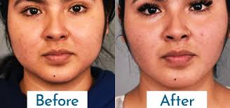 Dr. Megha Vyas January 2025