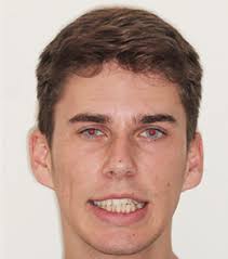 Book Your Orthodontic Consultation