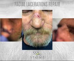 Dr. Mona Stone (@STONESURGICALA1)