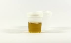 Check spelling or type a new query. Can Cloudy Urine Be A Sign Of Early Pregnancy