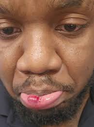 Traumatized NYC subway conductor 'having nightmares' after sicko punched  him and broke his teeth