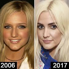 Ashlee Simpson Plastic Surgery Nose Job Before And After Celebrity Plastic Surgery Plastic Surgery Nose Job