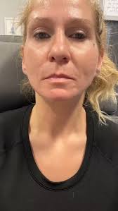 💉✨ Lip filler, but make it YOU. No duck lips, no overdone look just soft,  balanced, natural beauty tailored to YOUR face. 💋 As a Nurse Practitioner,  my mission is to enhance your features safely, ...