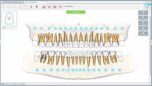 Dental Treatment Software