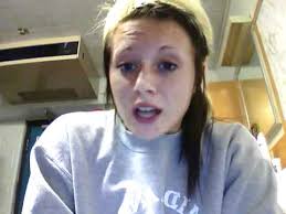 A variety of endocrine disorders. Mccune Albright Syndrome Youtube