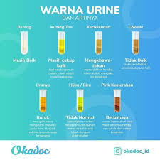 Air kencing warna coklat menunjukkan keadaan kesihatannya teruk. Urinesehat Explore Facebook