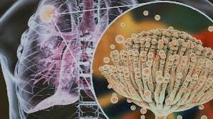 Dani Blackie is fundraising for Aspergillosis Trust