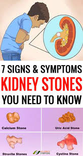 Pin On Allergy Symptoms