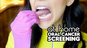 Some symptoms of mouth cancer are noticeable, that makes it possible to detect mouth cancer in its early stages. How To Screen For Oral Cancer At Home Youtube