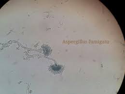 Aspergillus can cause neonatal infections. Aspergillus Fumigatus Microbiology Fungi Endocrine