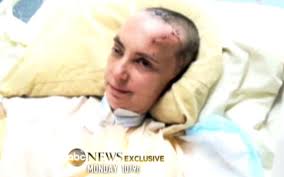 Reuters refuting the previous npr news, and states that giffords is still alive, in surgery, nine other patients brought in from shooting. Gabby Giffords In Shocking Hospital Photos Scarred And Bruised Recovering From Her Gunshot Wound New York Daily News