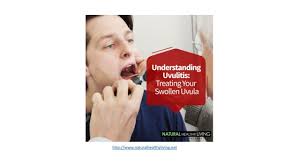 Image result for Uvulitis