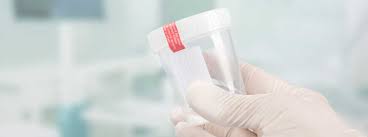 Was Tun Wenn S Brennt Bei Welchen Symptomen Mann Zum Urologen Gehen Sollte Ratgeber Magazin Tipps Von Kennstdueinen De