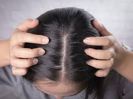 Some of these ways are natural methods while others are with. Expert Talk Kama Ayurveda S Dr Sharad Kulkarni On How To Treat Hair Loss Hair Thinning The Channel 46