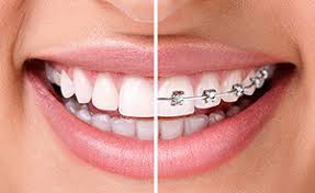 Get rid of your unwanted items and ensure. Orthodontics Auckland Orthodontic Problems
