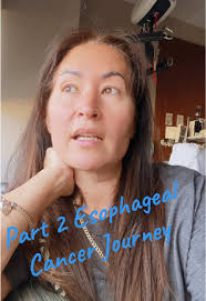 Esophageal Cancer Journey: Overcoming Challenges at Mayo