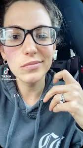 When a visit to the dentist turns you into Harvey Dent!