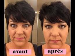 Poches Sous Les Yeux Comment S En Debarrasser En Quelques Jours Poches Sous Les Yeux Paupieres Gonflees Sous Les Yeux