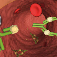 Image result for Infliximab