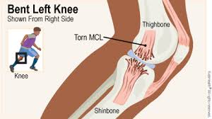 Leg muscles diagram starting know about wiring. Medial Collateral Ligament Mcl Injuries For Teens Nemours Kidshealth