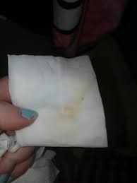Because it was an early pregnancy ultrasound, it was transvaginal to ensure. Brown Spotting In Early Pregnancy 9 Weeks