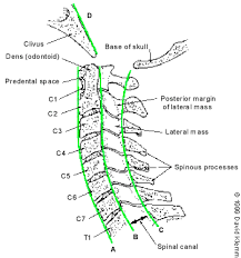 .body line) spinolaminar line cervical lordosis (cervical lordodic angle) cervical gravity line ruth of vertebral body to spinolaminar junction posterior vertebral body line lines/measurements of. Cervical Spine Radiographs In The Trauma Patient American Family Physician