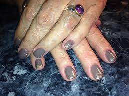 How To Video Of Acrylic On Psoriasis Nails By Michelle Cordes Http Youtu Be Vhien 3q9 K Nail Psoriasis Nails Psoriasis