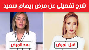 * ذكر من قال ذلك: Ø´Ø±Ø­ ØªÙØµÙŠÙ„Ù‰ Ø¹Ù† Ù…Ø±Ø¶ Ø±ÙŠÙ‡Ø§Ù… Ø³Ø¹ÙŠØ¯ ÙˆÙ„Ù…Ø§Ø°Ø§ Ù‡Ùˆ Ø®Ø·ÙŠØ± Ø¬Ø¯Ø§ ÙˆÙŠØµØ¹Ø¨ Ø¹Ù„Ø§Ø¬Ù‡ Youtube