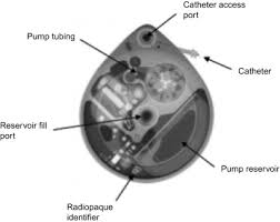 Haben sie fragen zu lieferterminen, reparaturaufträgen oder ersatzteilbestellungen? Implantable Drug Delivery Devices Sciencedirect