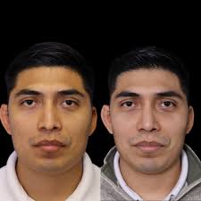 Savannah Facial Plastic Surgery