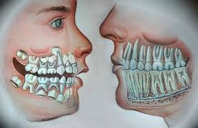 Pin On Dental Education